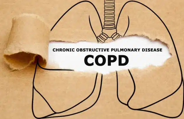 What Is Chronic Obstructive Pulmonary Disease? Doctor Shares Strategies To Control Flare-Ups And Exacerbations Caused By COPD
