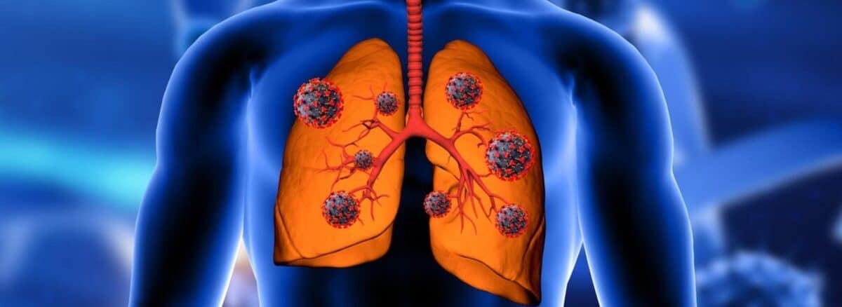 Why September Matters for Your Lung Health: Understanding Post-Monsoon Respiratory Risks