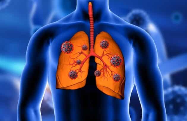 Why September Matters for Your Lung Health: Understanding Post-Monsoon Respiratory Risks